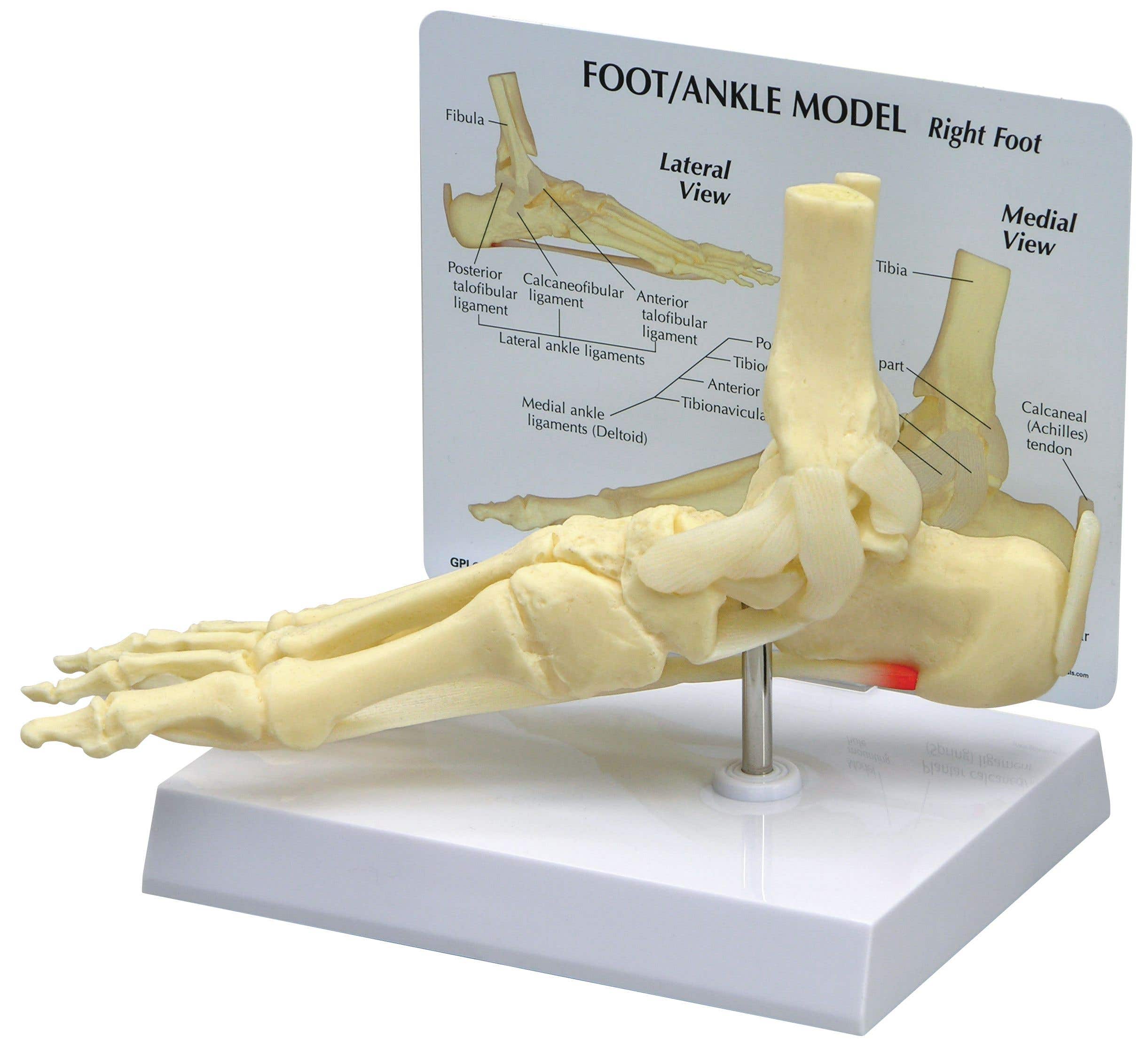 Ankle/FootPlantarFasciitisW/KeyCard