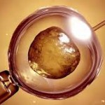 FDA Approves Stem Cells for Spinal Cord Injuries