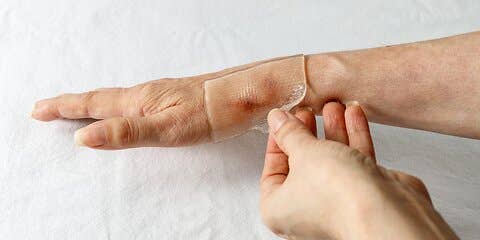 am-buying-guide-products-wound-care-buying-guide-to-wound-care-medical-supplies-4
