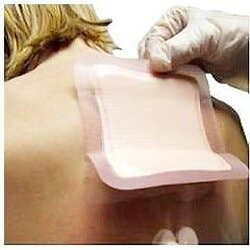 Allevyn Adhesive Hydrocellular Dressing - 5 x 5"