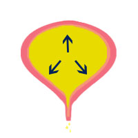 Overflow Incontinence